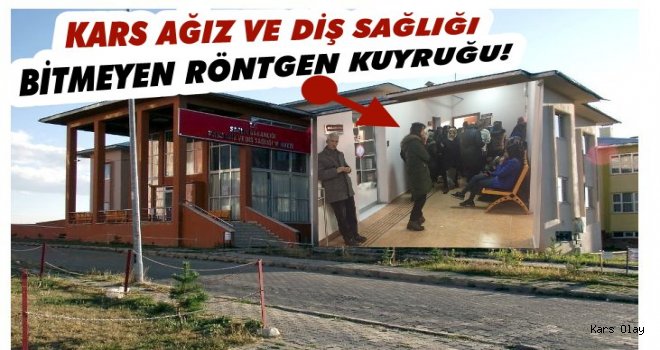 Kars Ağız ve Diş Sağlığının Bitmeyen Röntgen Kuyruğu!